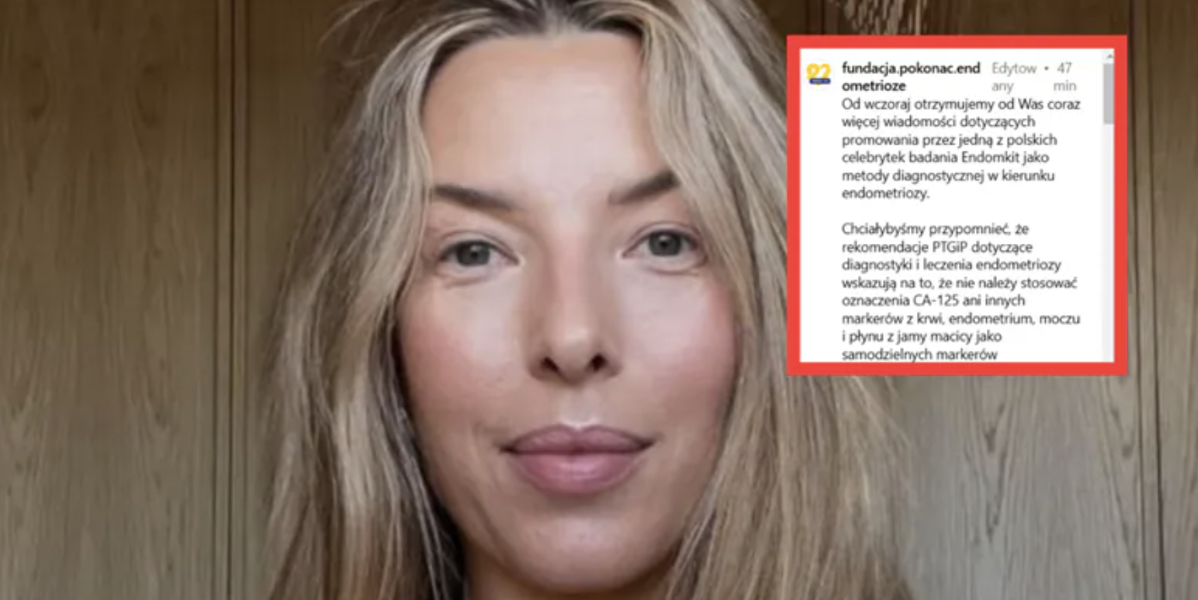 Lekarze przeciwko Chodakowskiej. „Chciwość celebrytów nie zna granic”