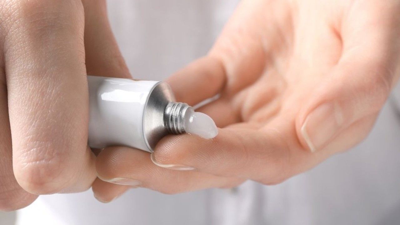 Kosztuje tylko 20 zł, pomoże zlikwidować pajączki i nie tylko. Ta maść to hit