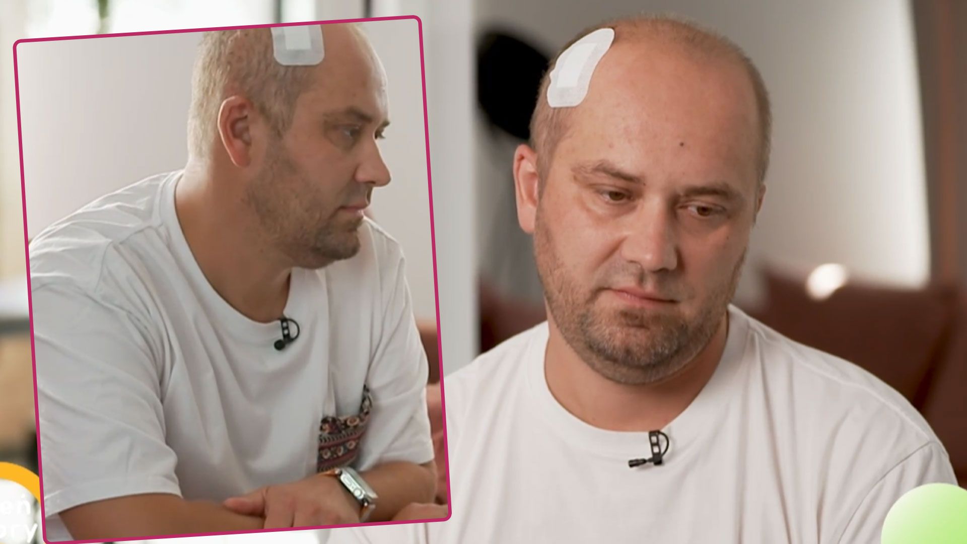 Takie były pierwsze objawy glejaka. „Przecierałem oczy ze zdumienia”. Gwiazdor TVN nie przypuszczał, iż usłyszy najgorsze