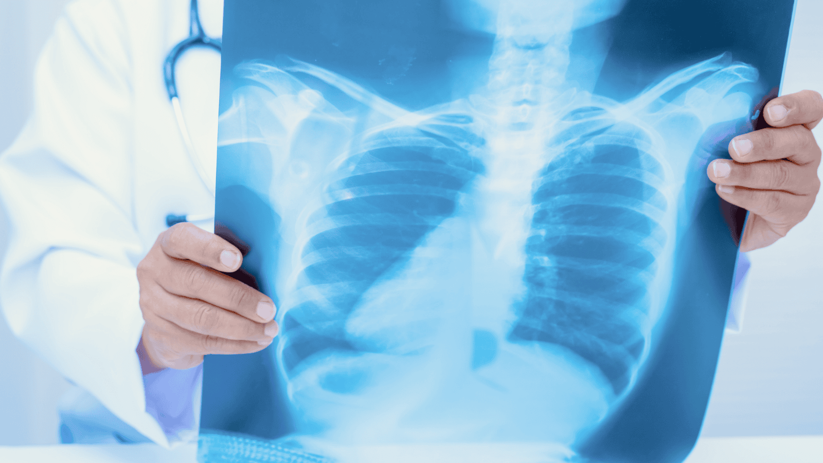 Wraca zapomniana choroba. Na początku brak objawów, ale pacjent zaraża