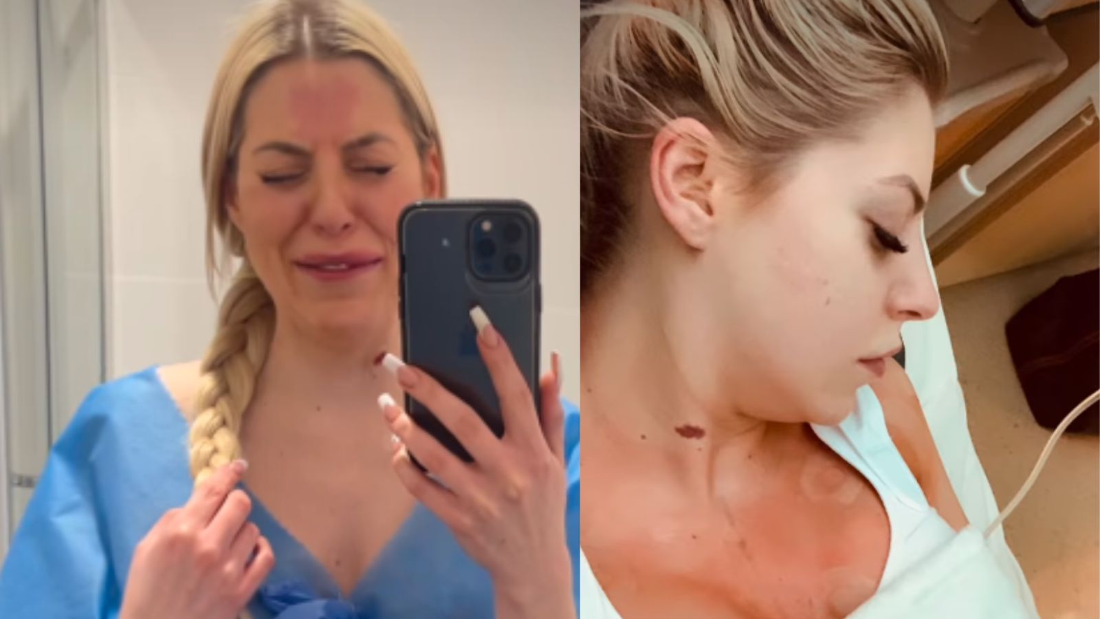 Julia von Stein oskarża chirurga po 9-godzinnym liftingu twarzy. Dr Piotr Janik zapowiada kroki prawne