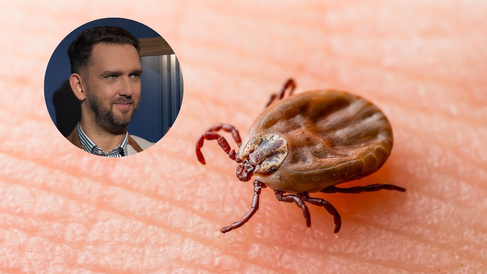 Borelioza: antybiotyk tylko przy rumieniu wędrującym, badania krwi dopiero po 6-8 tygodniach