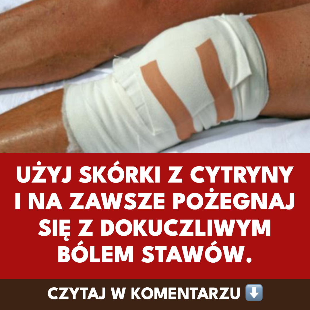 Skórka z cytryny na bóle stawów — domowy okład, który stosuje się od pokoleń
