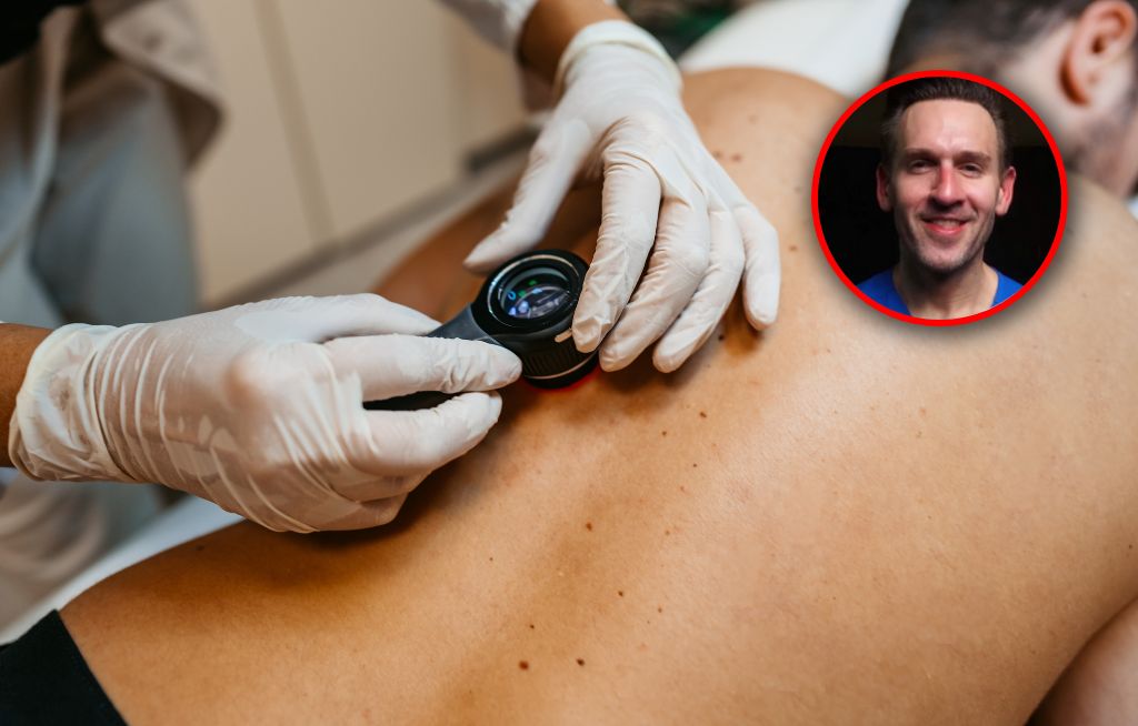Dermatolog pokazał zdjęcia czerniaków: "Większość z nich wcale nie jest oczywista do zauważenia"